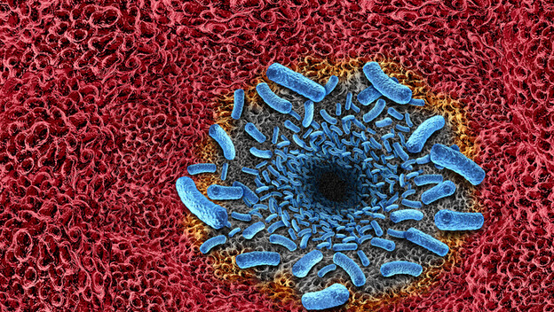 Bakterija koja jede meso, ilustracija
