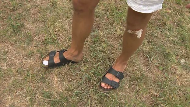 Pretučeni mladić - 3