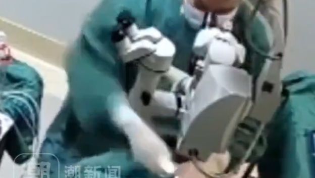 Kirurg udara pacijenticu za vrijeme operacije