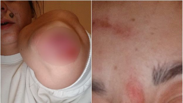 Napadnuta Nives Arnautović