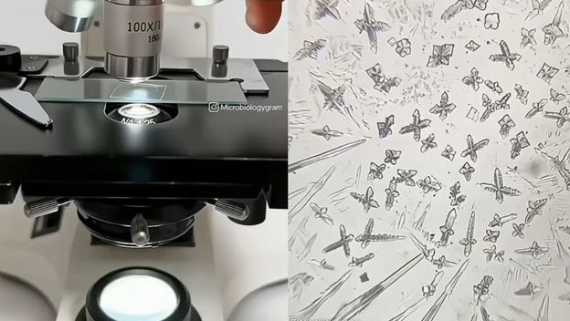 Suza pod mikroskopom