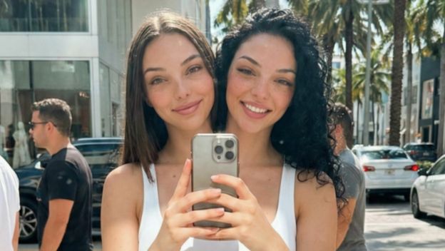 Sijamske blizanke Valeria i Camila