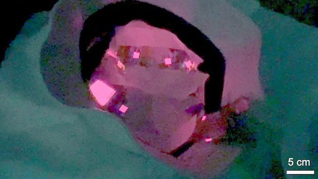 Kapa s OLED diodama za svjetlosnu terapiju vlasišta