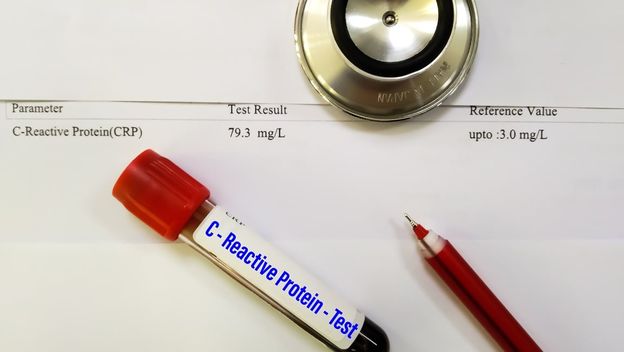 Hrana koja smanjuje CRP: Što jesti da upala prođe prirodnim putem?