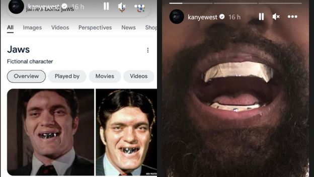 reper kanye west s otvorenim ustima i novom navlakom nalik na lik pored njega imena Jaws iz filmova o jamesu bondu