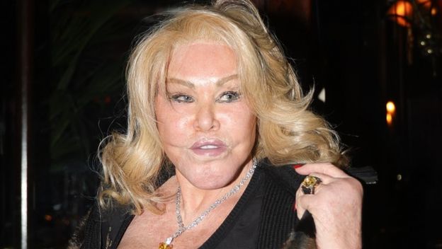 Jocelyn Wildenstein - 1