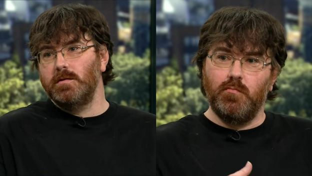 Amerikanac Michael Phillips kako razgovara o svom mikropenisu