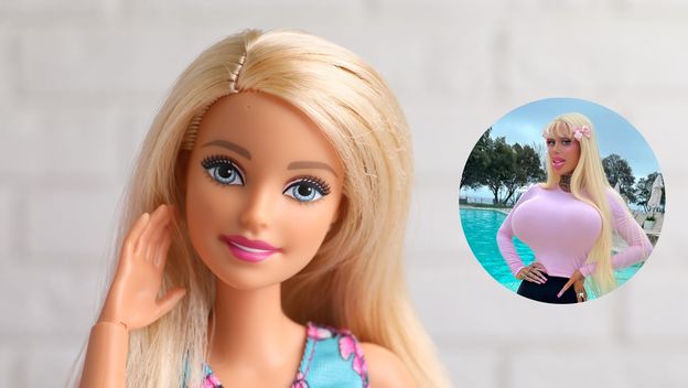 Alicia Amira prije i poslije operacije