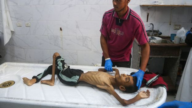 Djeca gladuju u Gazi