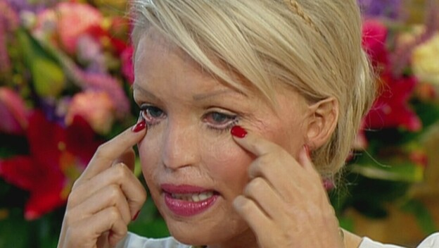 Katie Piper - 5