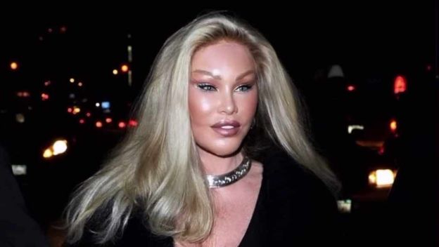 Jocelyn Wildenstein