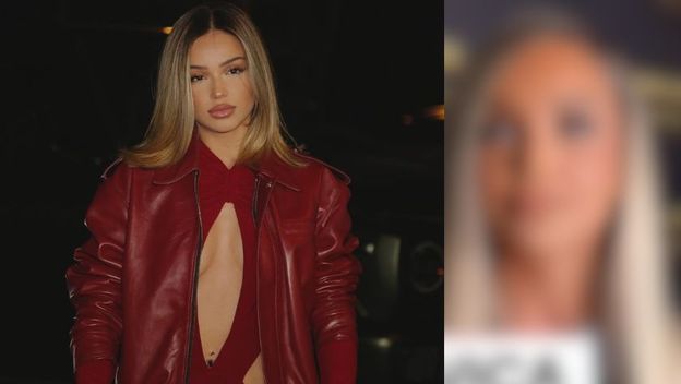 Breskvica prije vs. sada