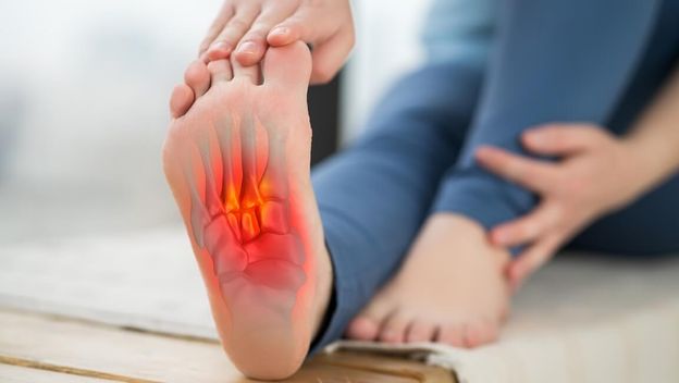 Plantarni fascitis: Zašto vas peta boli pri prvim jutarnjim koracima?