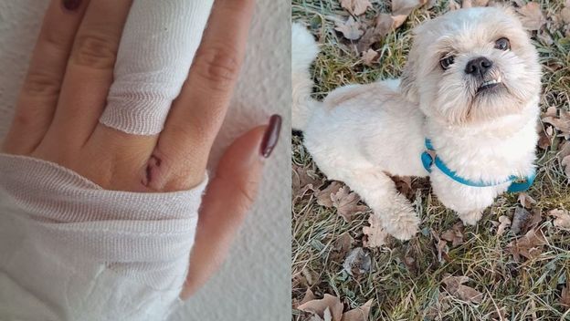 Helena Leko zadobila je ozljede dok je pokušala spasiti svojeg psića