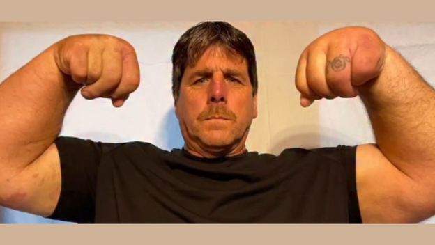 Jeff Dabe i njegove ogromne ruke