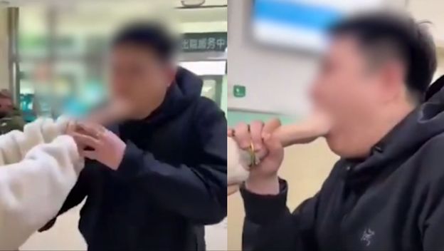 Muškarac s rukom djevojke zaglavljenom u ustima