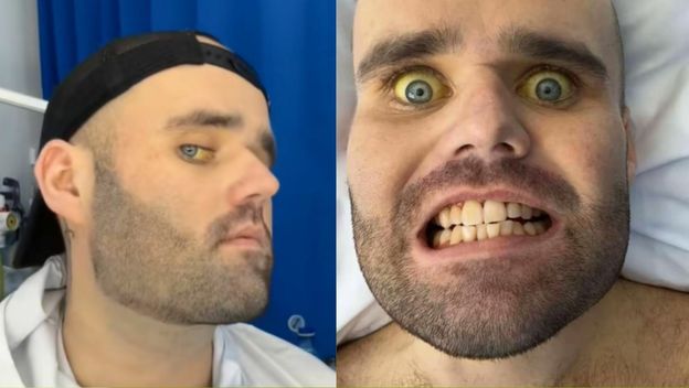 Sean Holland i njegovi simptomi alkoholizma