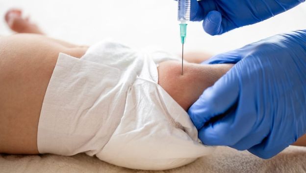 Sve više roditelja odbija ovu injekciju za bebe – liječnici upozoravaju na ozbiljan rizik za mozak!