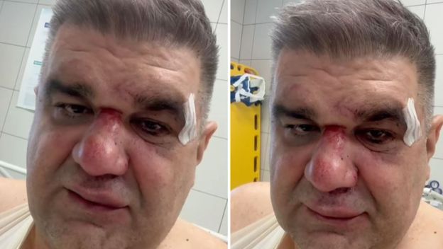 Pretučeni srpski menadžer Saša Mirković