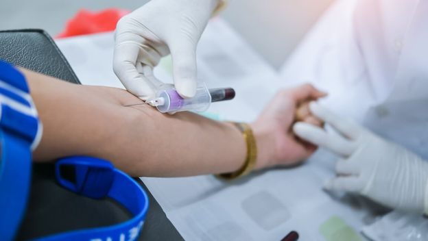 Ovaj “skriveni” kolesterol mnogi nikad ne provjere, a povećava rizik od moždanog udara!