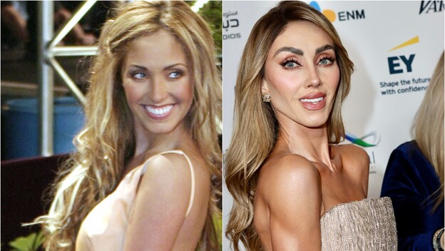 Anahi