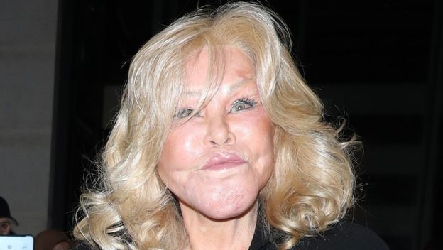 Jocelyn Wildenstein