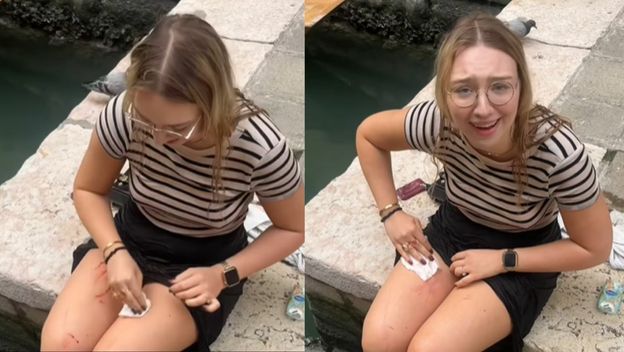 Poljska turistica nakon nezgode u Veneciji