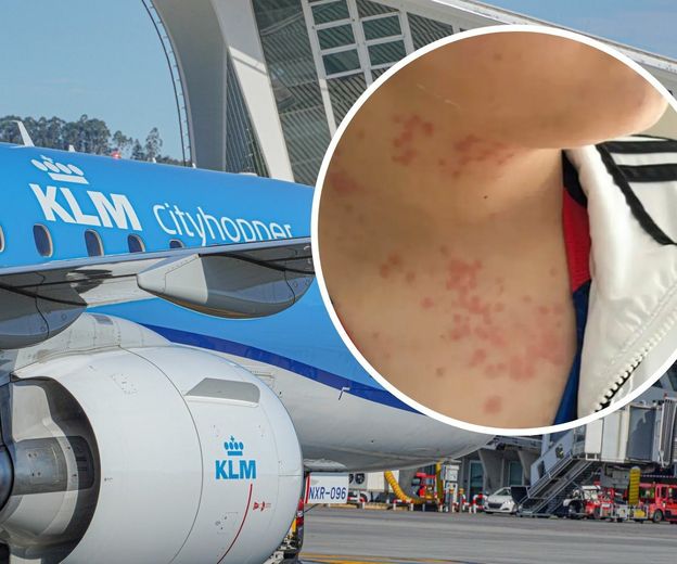 Stjenice u zrakoplovu