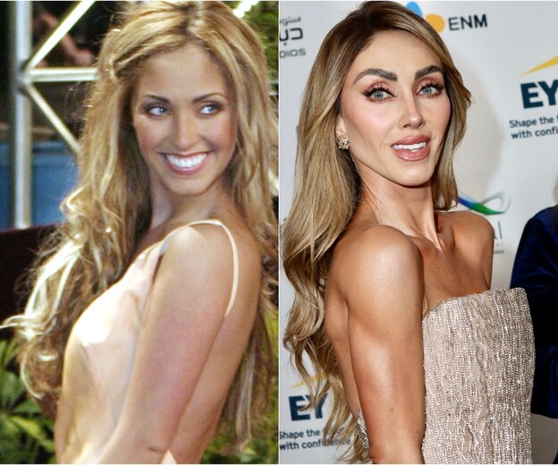 Anahi