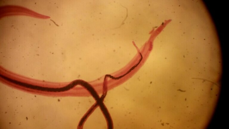 Schistosoma mansoni