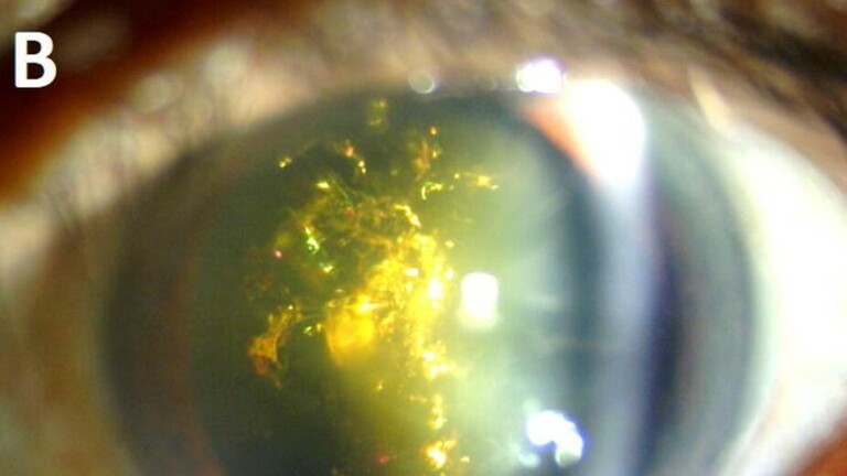 Bolest mrene božićnog drvca