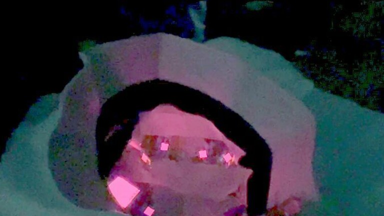 Kapa s OLED diodama za svjetlosnu terapiju vlasišta