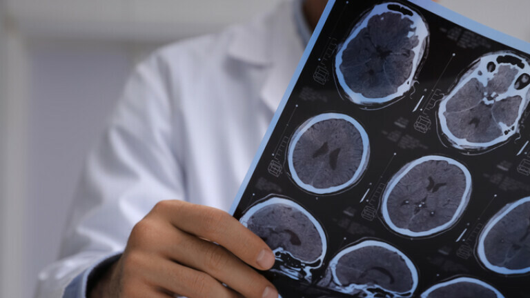 Liječnik promtra MRI snimku mozga, ilustracija