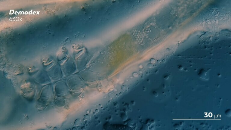 Demodex