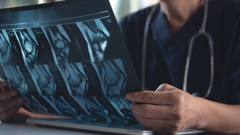 Liječnik proučava rentgensku snimku, ilustracija