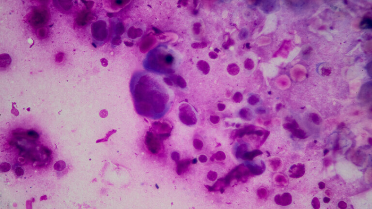 Laboratorijski uzorak herpesa, ilustracija