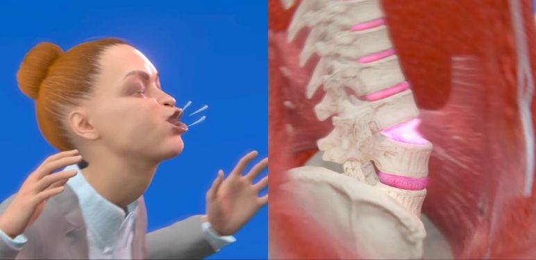Simulacije ozljede Victorije Kenny koja je kihanje ozlijedila kralježnicu