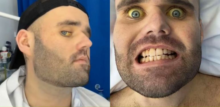 Sean Holland i njegovi simptomi alkoholizma