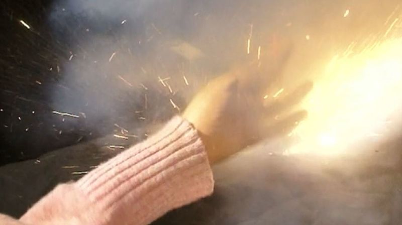 Posljedice rukovanja petardama (Foto: Dnevnik.hr) - 1