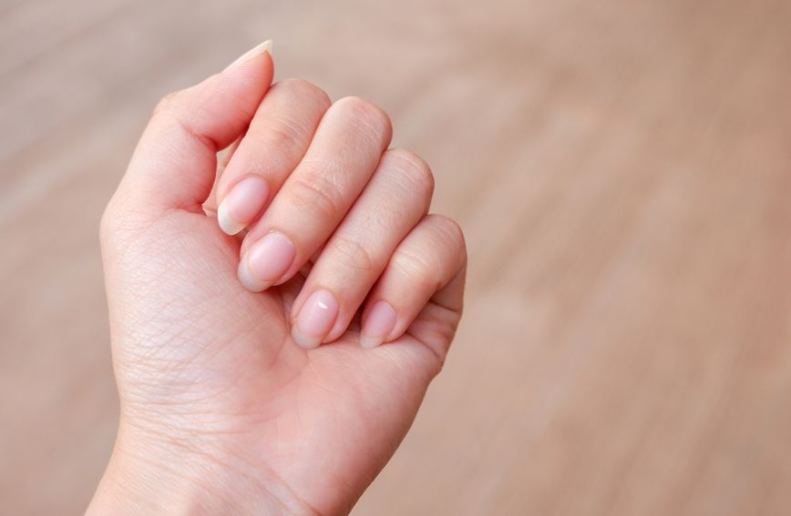 Bijele mrlje na noktima pokazatelj su brojnih promjena u organizmu