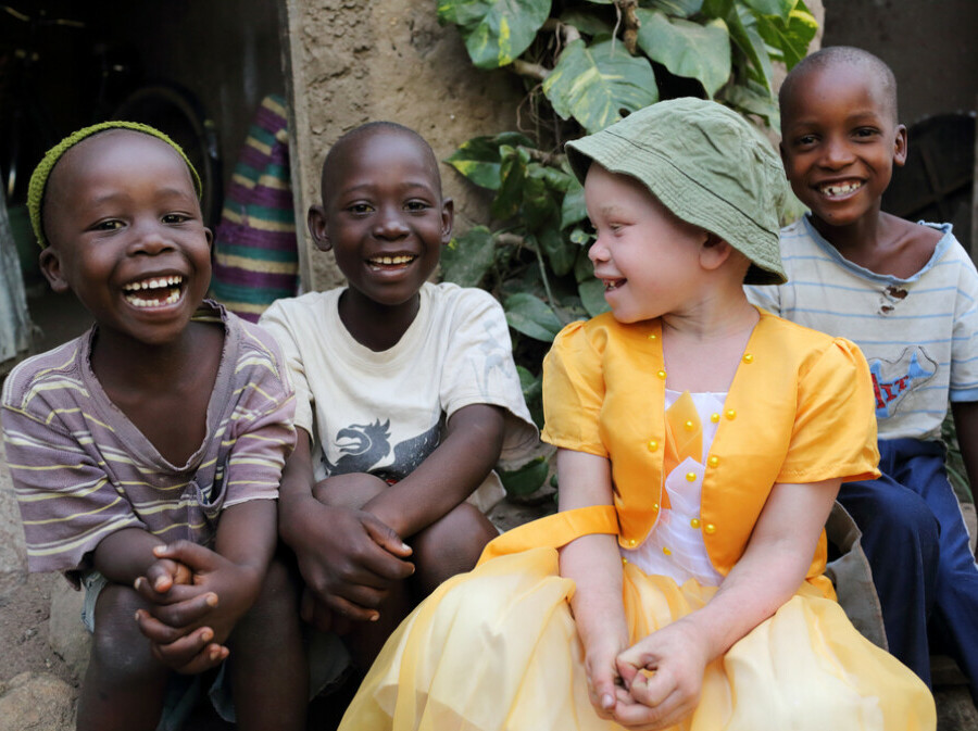 Albinizam u Africi (Ilustracija) - 1