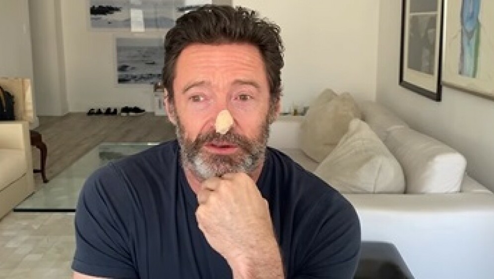 Hugh Jackman - 2