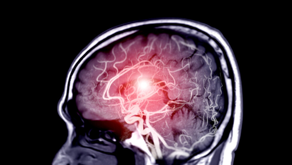 Snimka čovjekova mozga, ilustracija