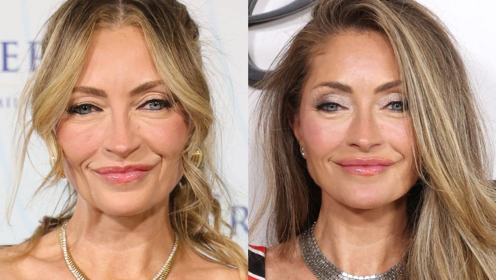 Rebecca Gayheart prije i poslije facelifta (zatezanja lica)