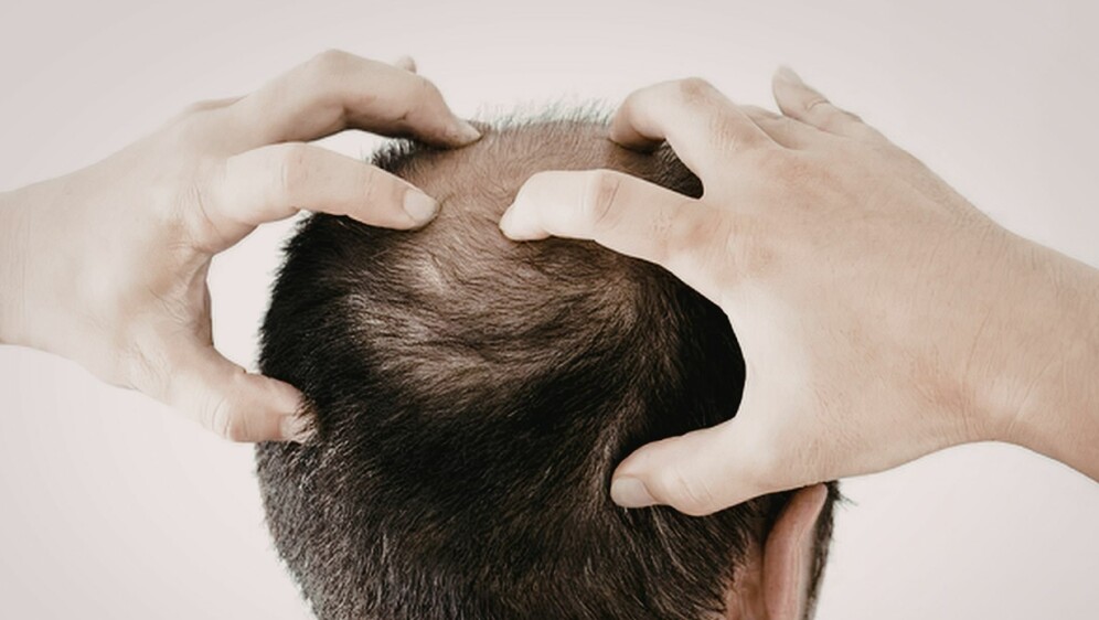 Ćelavi muškarac s rukama na glavi