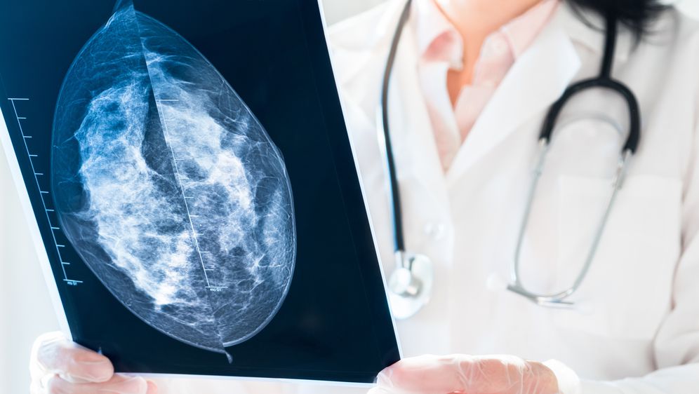 Pregled mamografske snimke, ilustracija