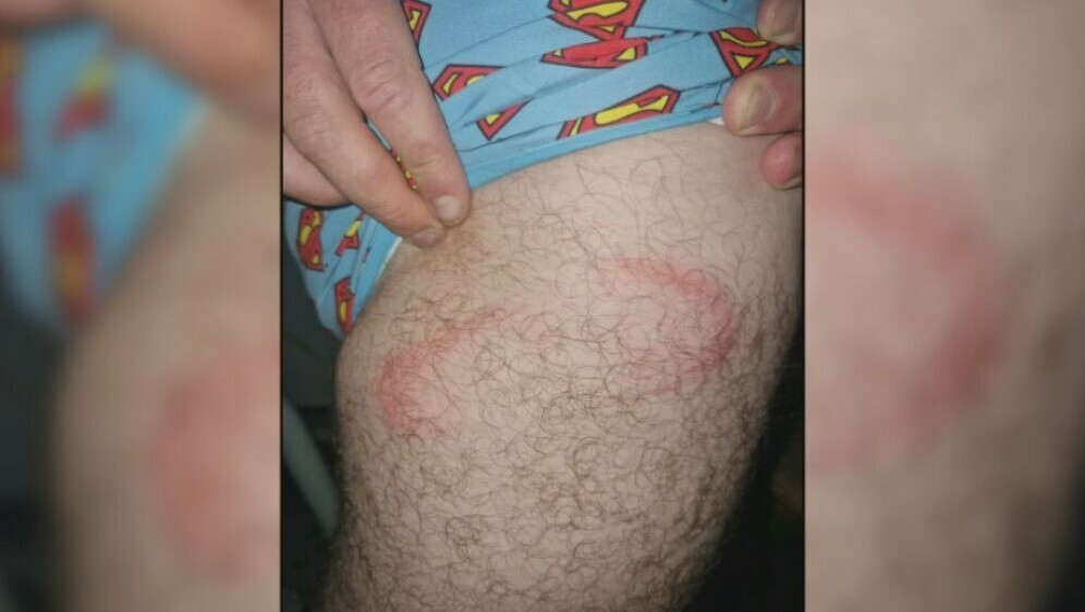 Ugriz kornjače, ilustracija - 1