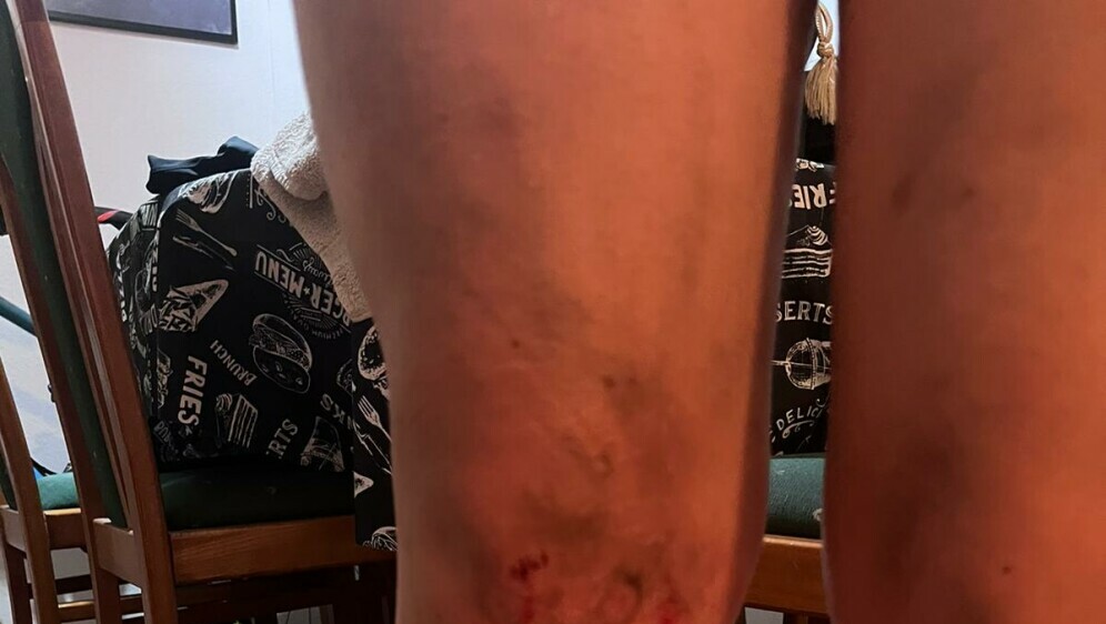 Ozlijeđena djevojka - 5