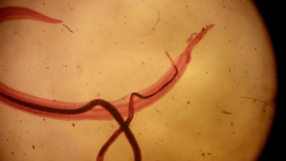 Schistosoma mansoni