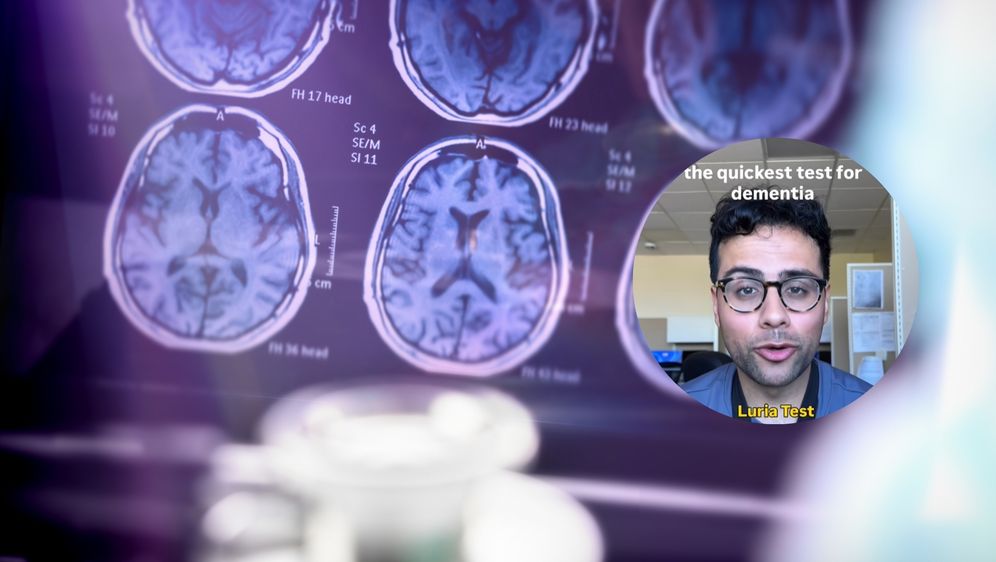 Snimke mozga i neurolog koji objašnjava test za demenciju